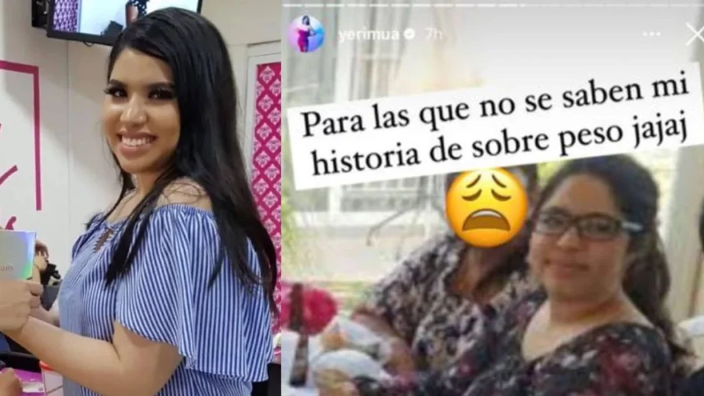 Yeri Mua antes de la lipopapada, la rinoplastía y el aumento de labios